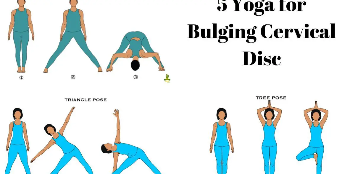 5 Yoga for Bulging Cervical Disc